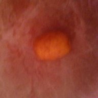Potato PTDR
