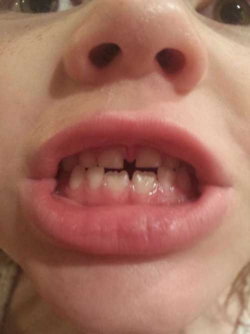 when-you-see-it-batman-teeth.jpg