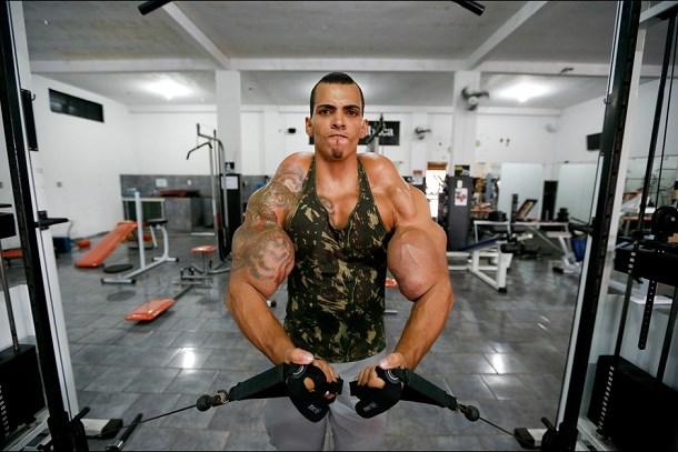 muscle-bresil-synthol-injection-body-building-7.jpg